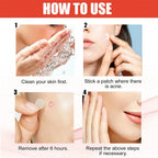 240pcs New Pimple Patch Acne Patches Heart/Star/Flower/Round Shape Acne Dots Patches Moisturizes for Covering Zits and Blemishes