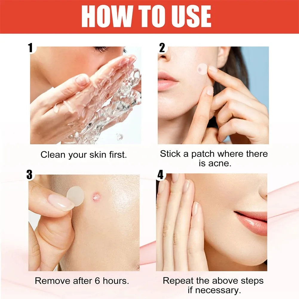 240pcs New Pimple Patch Acne Patches Heart/Star/Flower/Round Shape Acne Dots Patches Moisturizes for Covering Zits and Blemishes